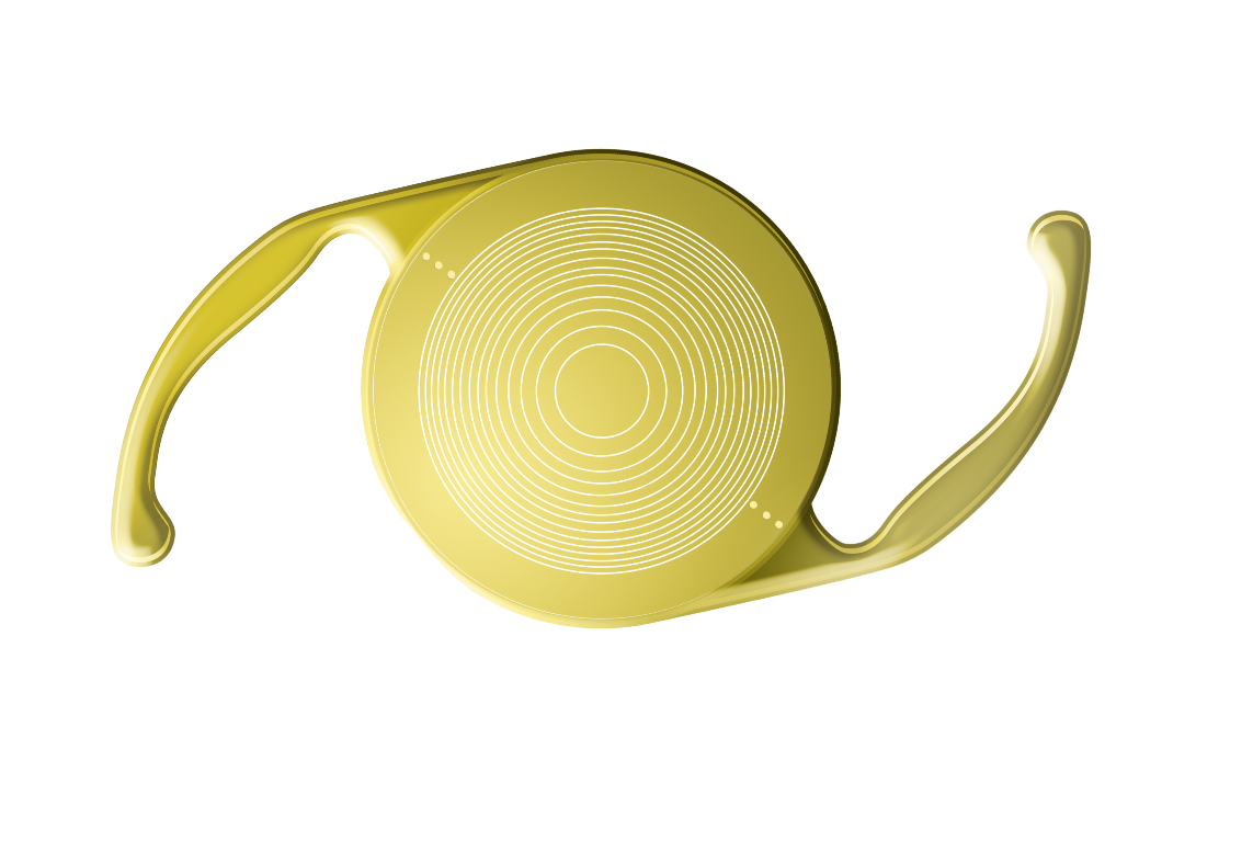 Multifokale Intraokularlinsen (IOL)