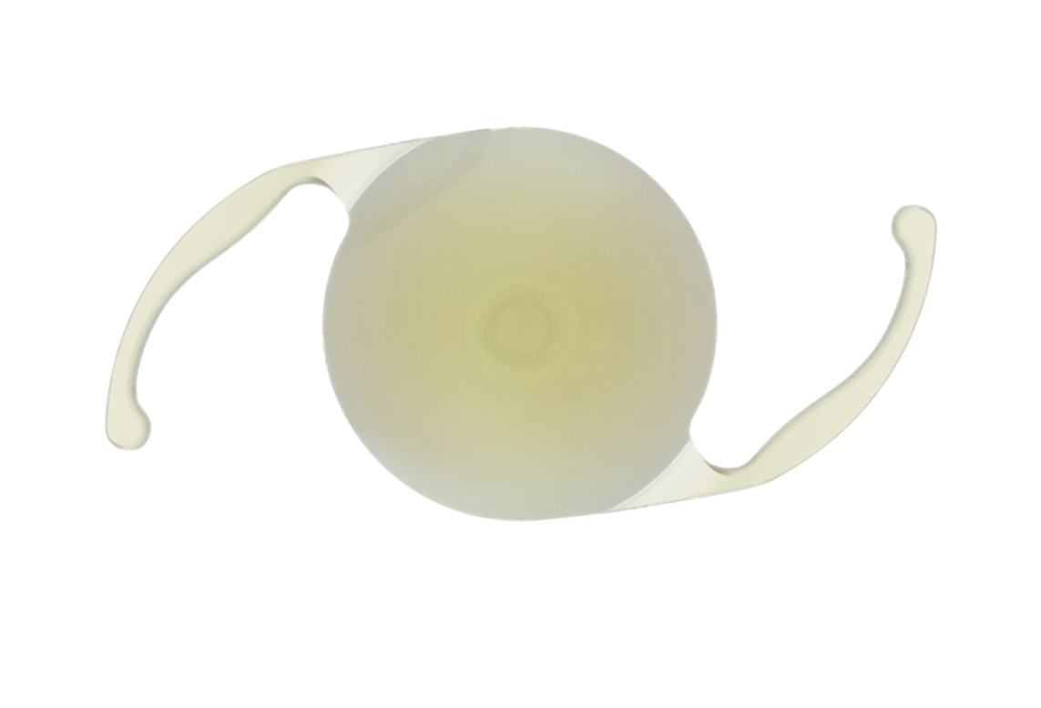 EDOF-Intraokularlinsen (Extended Depth of Focus)