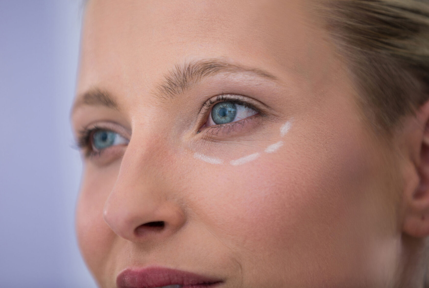 Woman with markings drawn on her body for a cosmetic procedure